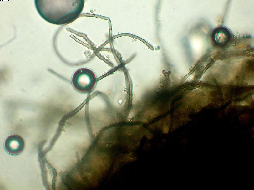 Dumontinia  tuberosa     ( Bull. )   L. M. Kohn.